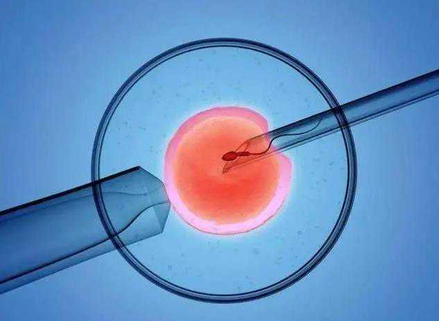 重庆助孕女性条件需关注的关键事项