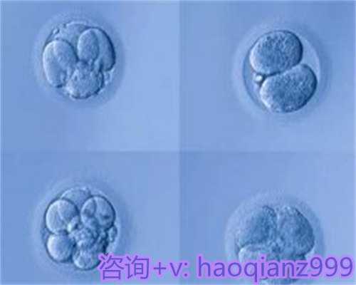 新生儿超重原因解析:重庆助孕需警惕遗传疾病风险