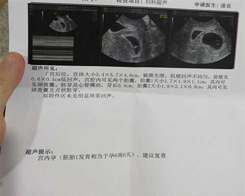 重庆助孕晚期腰疼的有效治疗方法与预防措施