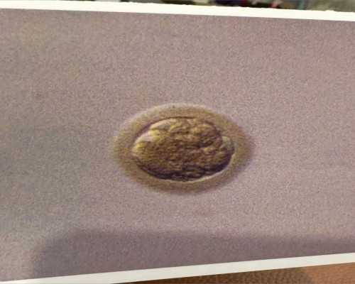 男性精子质量不佳能否通过重庆试管助孕实现生育