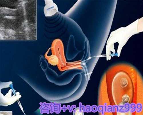 婴儿八个月频繁摇头的原因解析